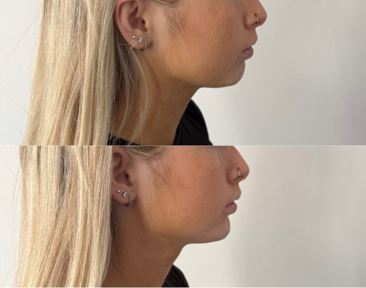 Magdalena Kawecka-11