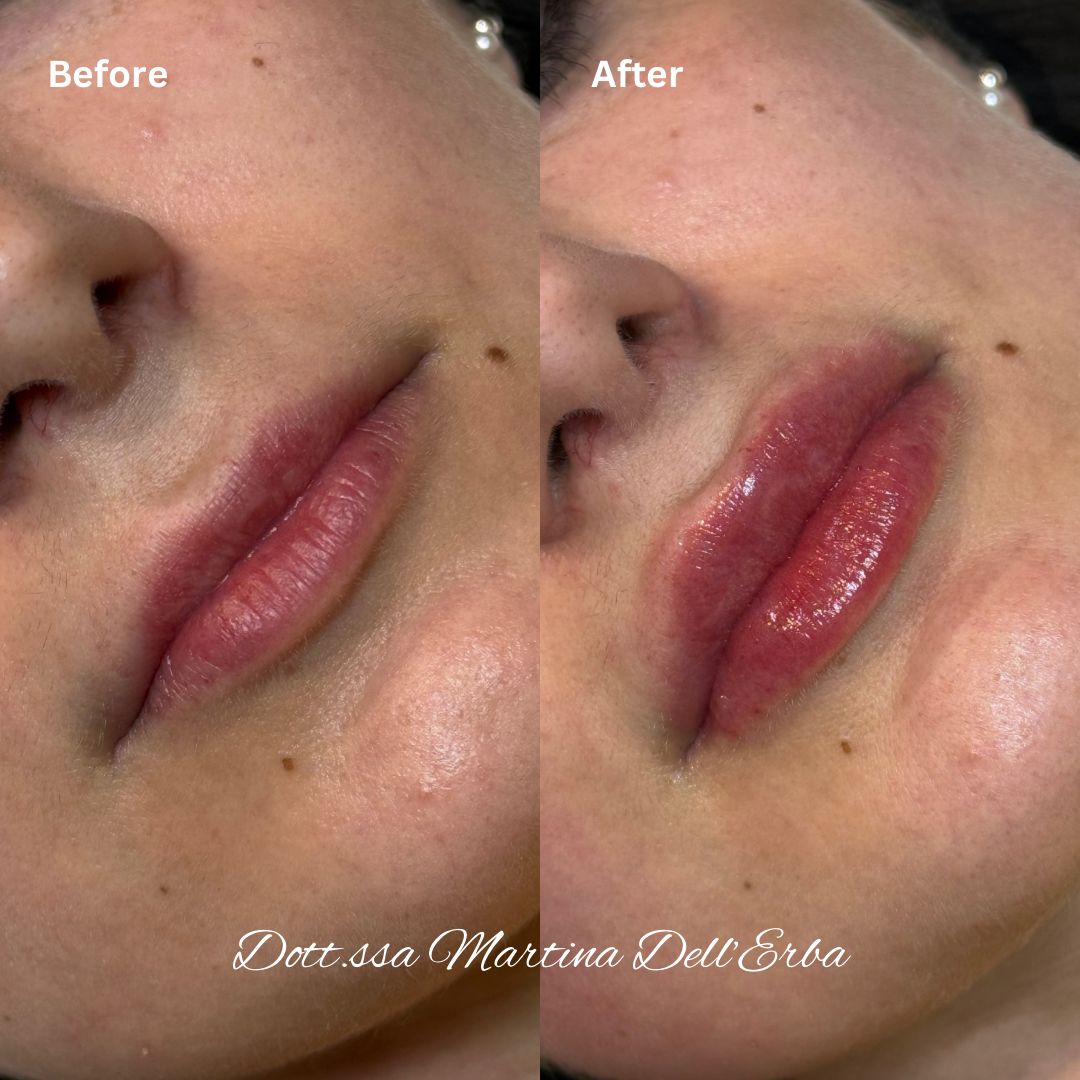 Martina Dell'erba-19