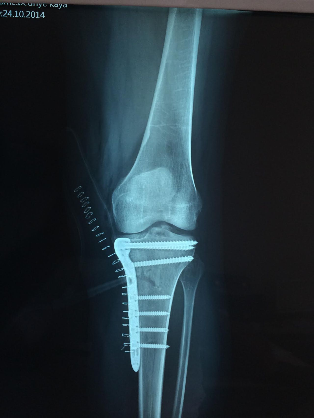 Mehmet Hakan Yılmaz-11