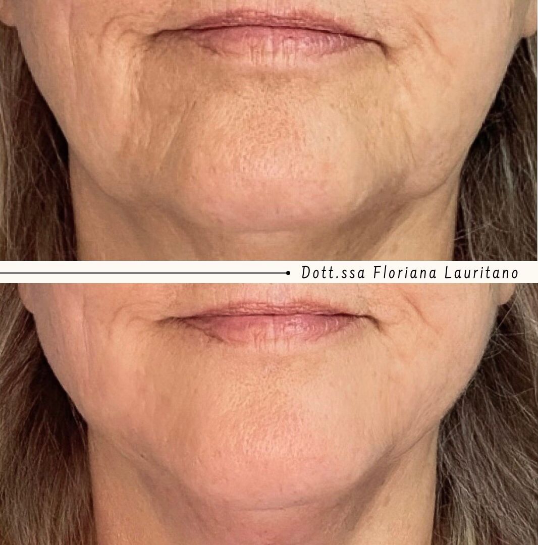 Floriana Lauritano-22