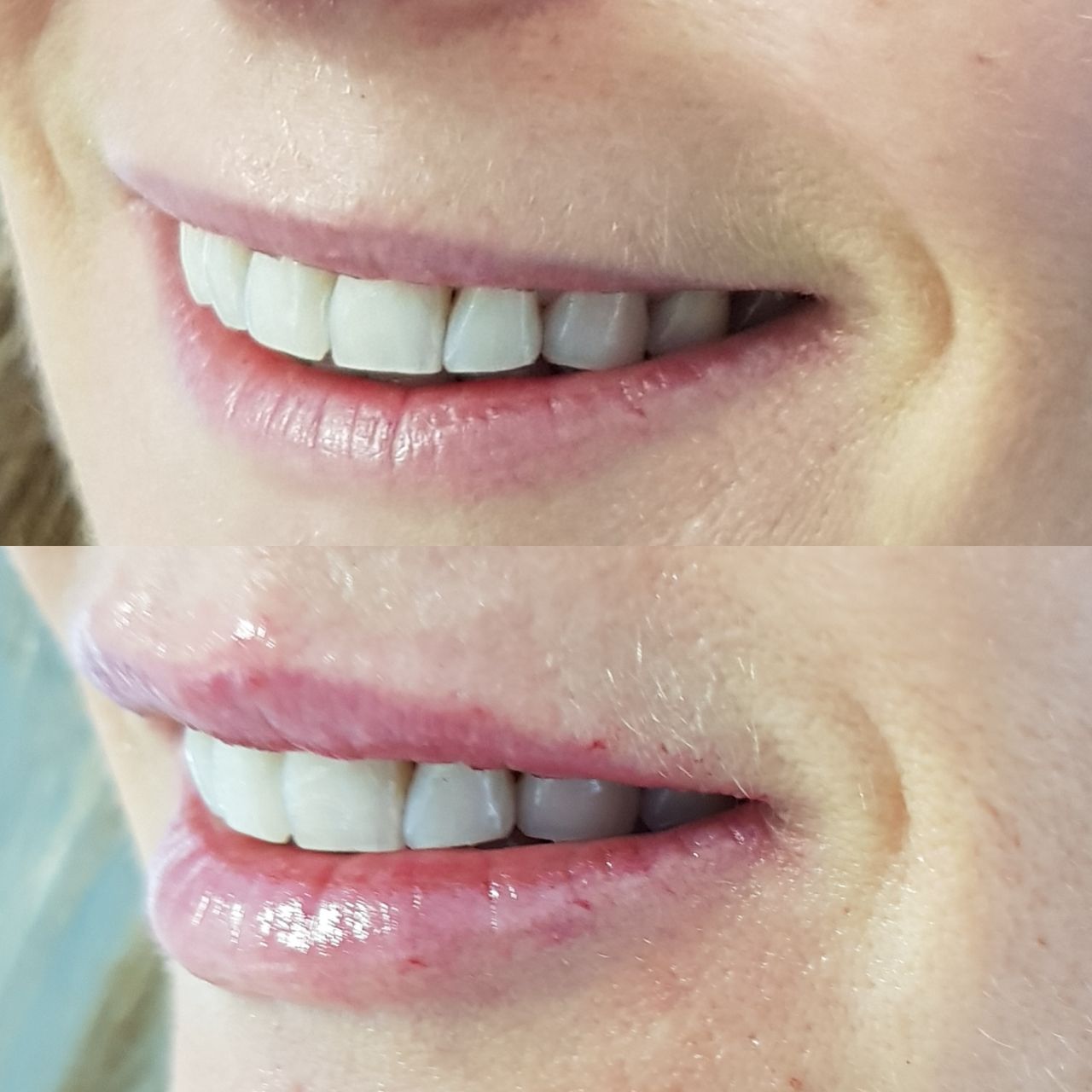 Rosalba Herrero Zerpa-196