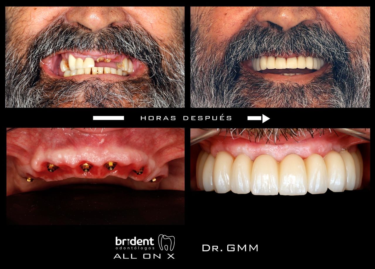 Guillermo Moreno Masiá-87