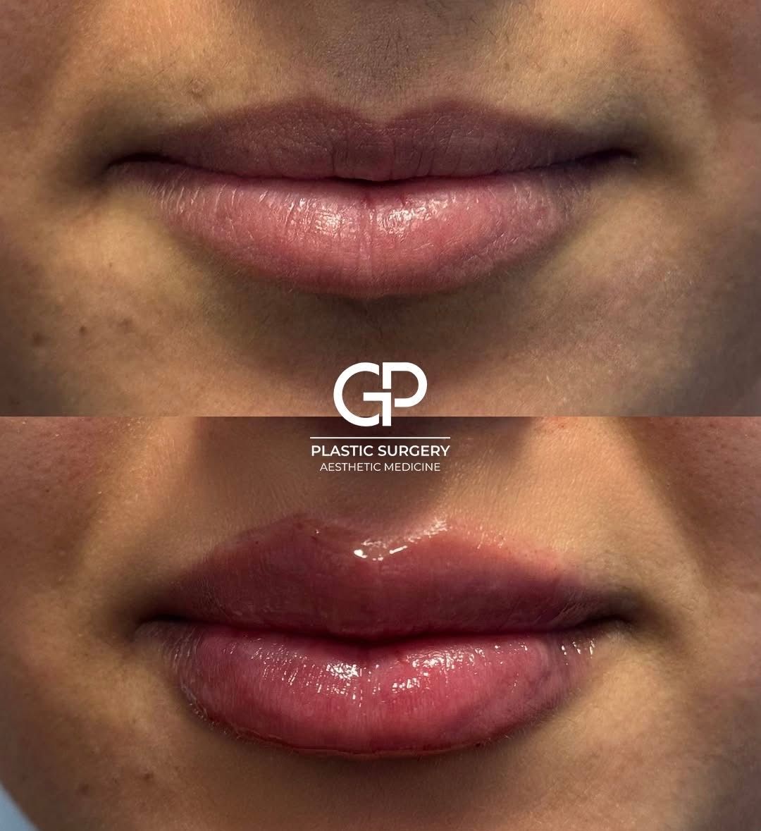 Gianmarco Polverino-0