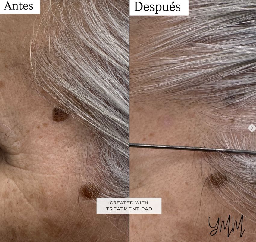 Yesliet Martínez Martínez-4