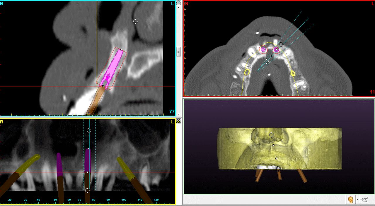 Alessandro Palumbo-14
