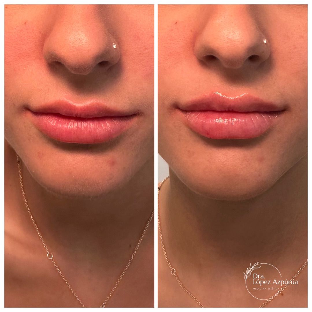 Alexandra López Azpúrua-1