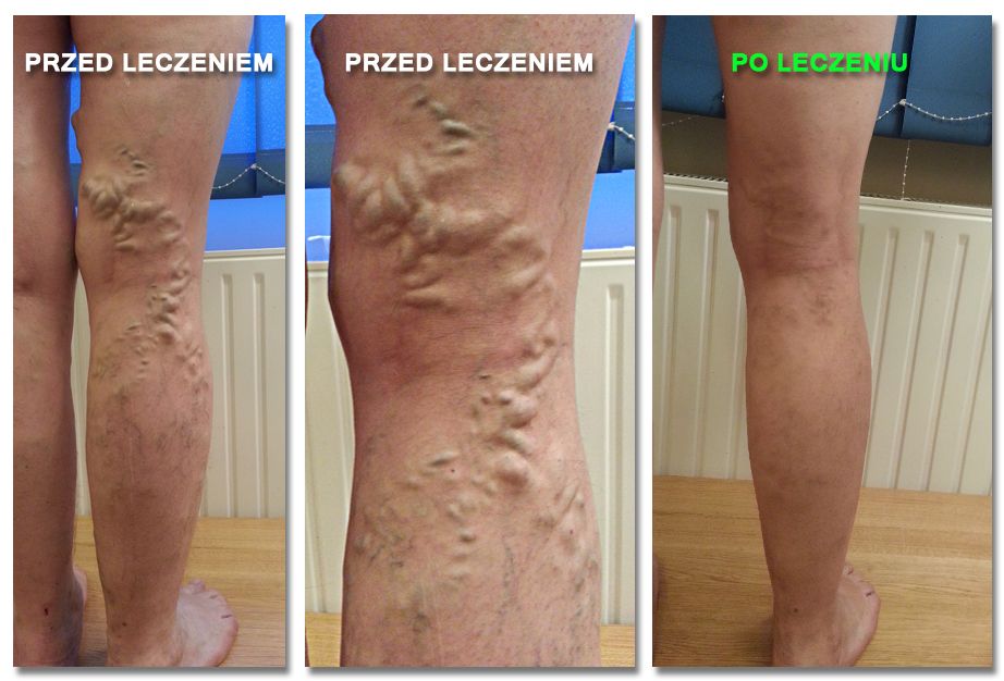 Tomasz Krzysztof Kwiatkowski-2