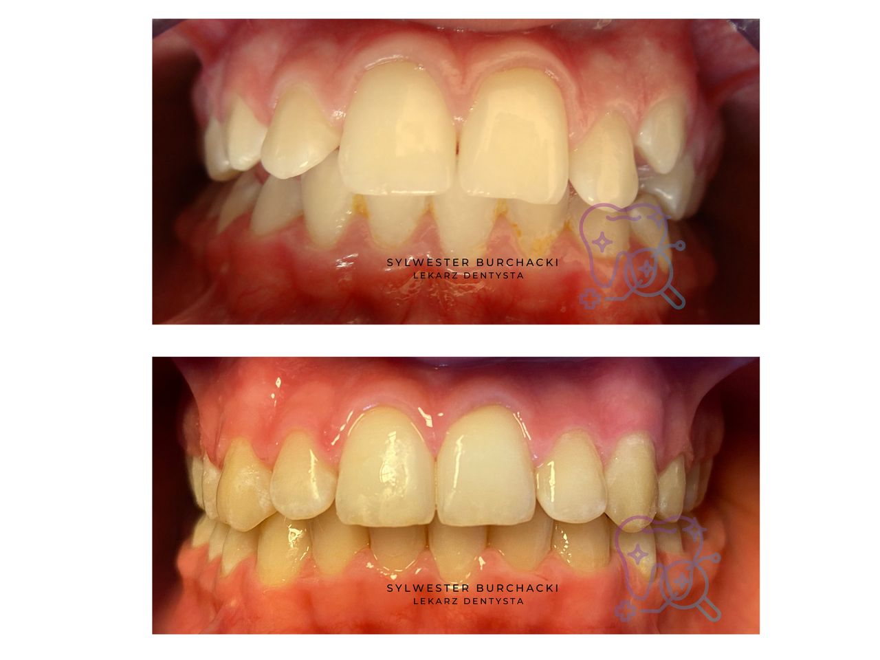 Sylwester Burchacki-2