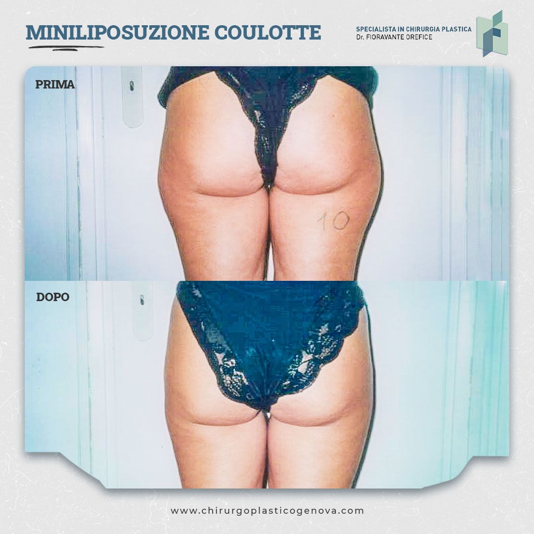 Fioravante Orefice-14