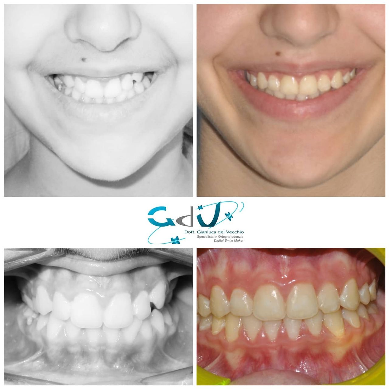 Gianluca Del Vecchio-93