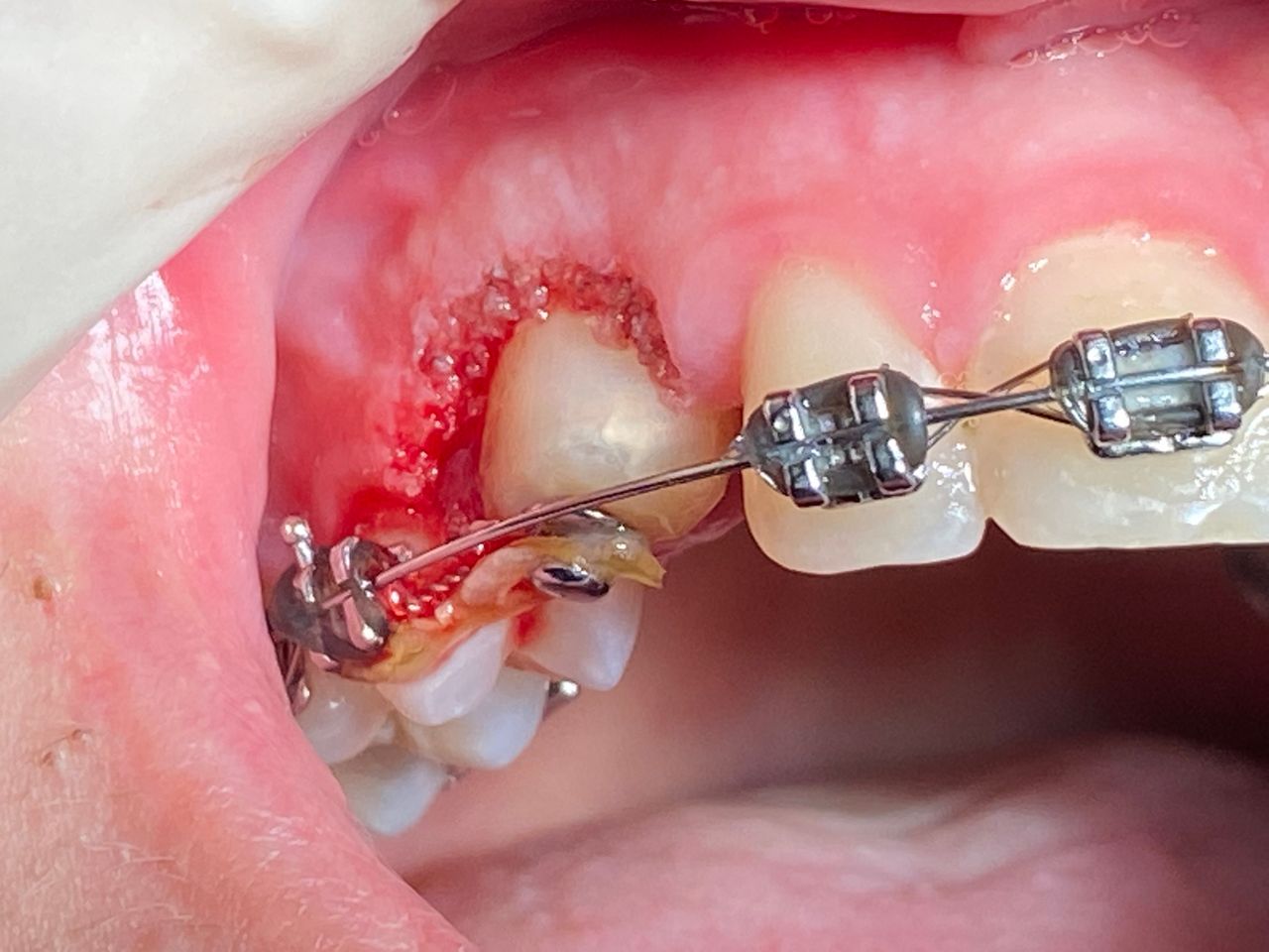 Luigi Giuseppe Romano-6