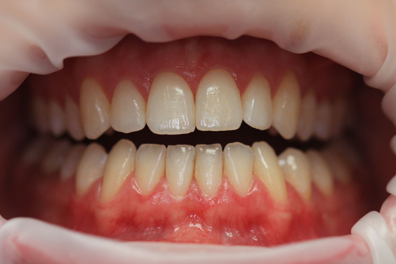 Paulina Sawicka-Soszyńska-25