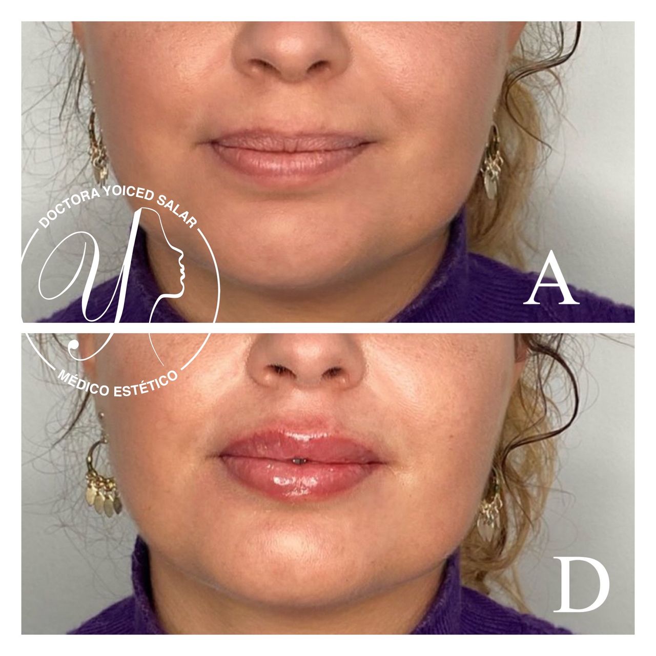 Yoiced Salar Peñate-7