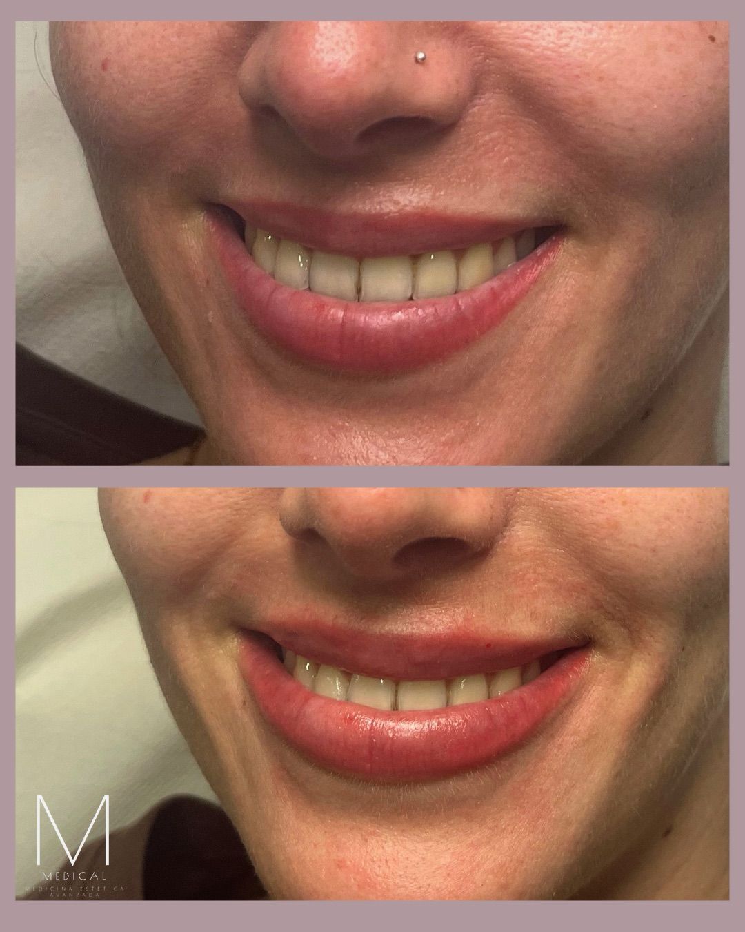 Marta Reyes Álvarez-9