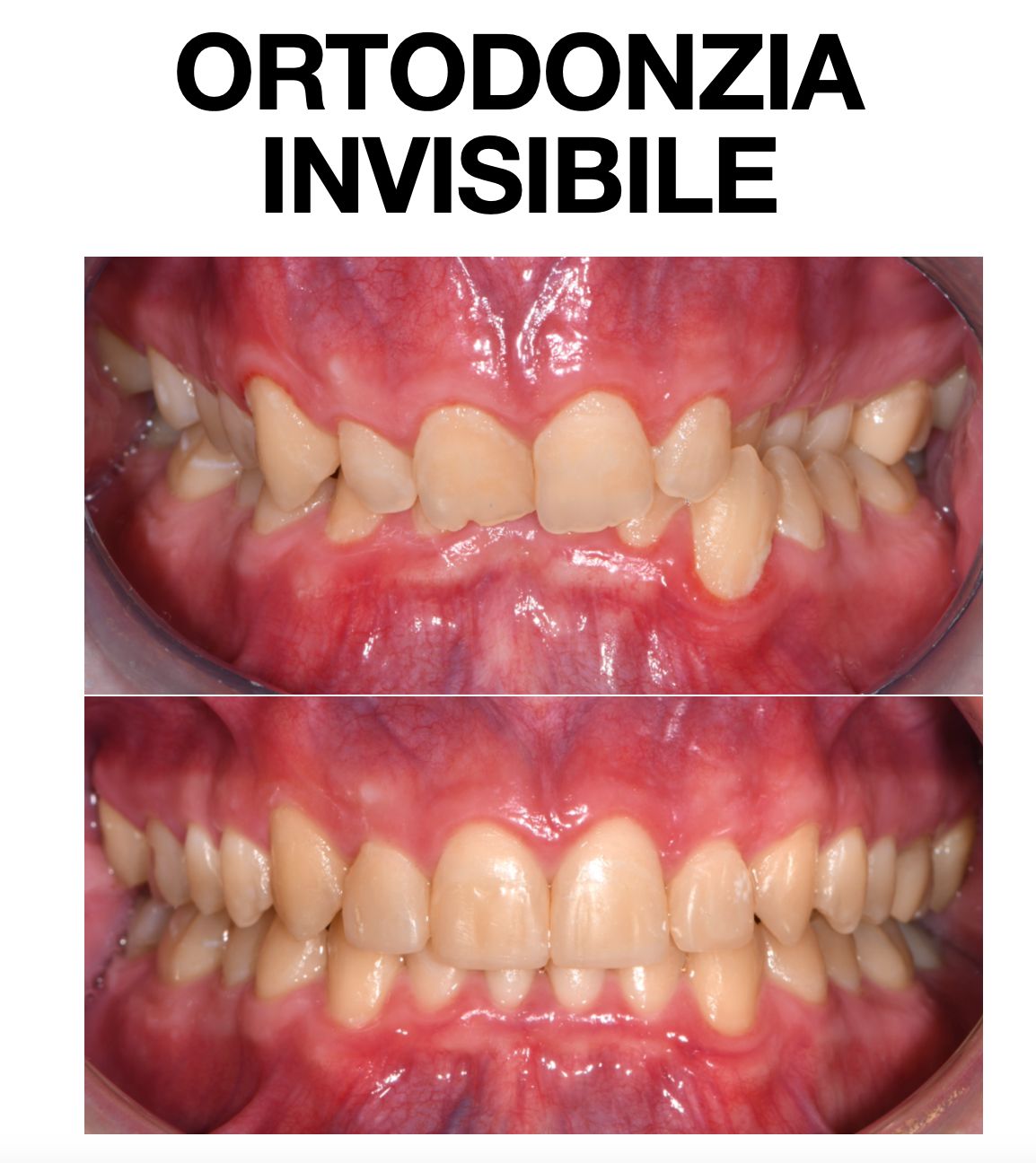 Riccardo Michelotto Tempesta-7