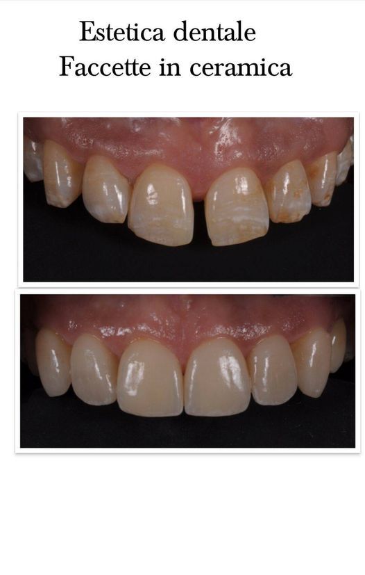 Saverio Giugliano-12