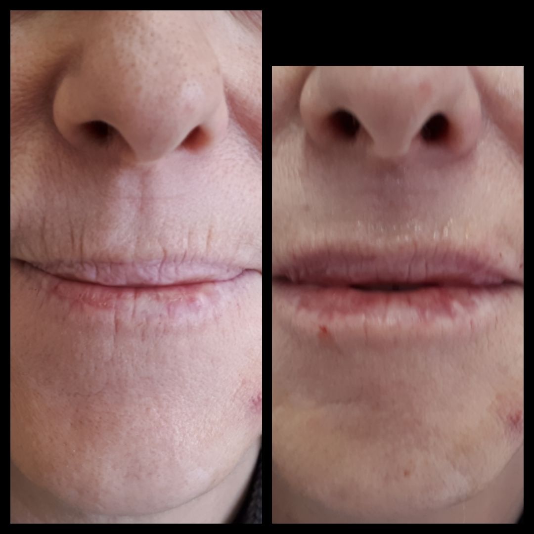 Andrea Menichelli-22