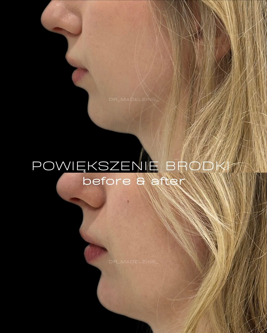Magdalena Taszycka-10