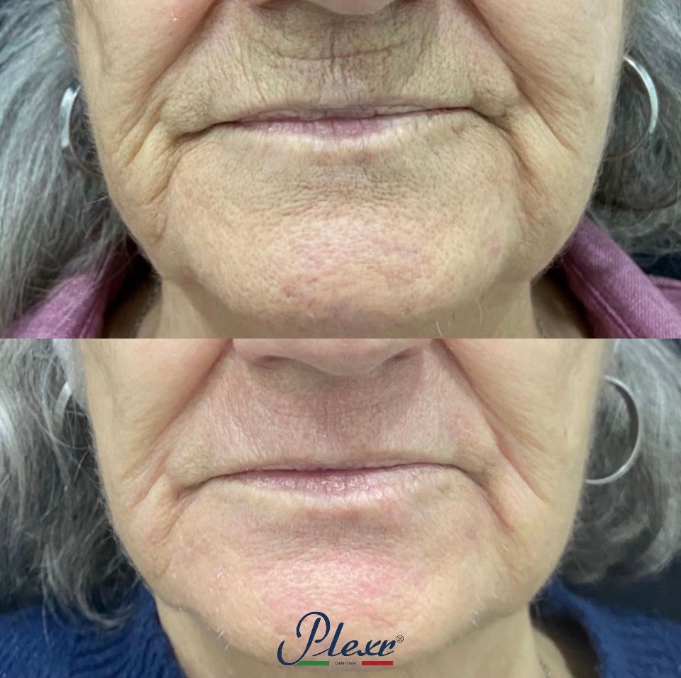 Raffaele Del Prete-16