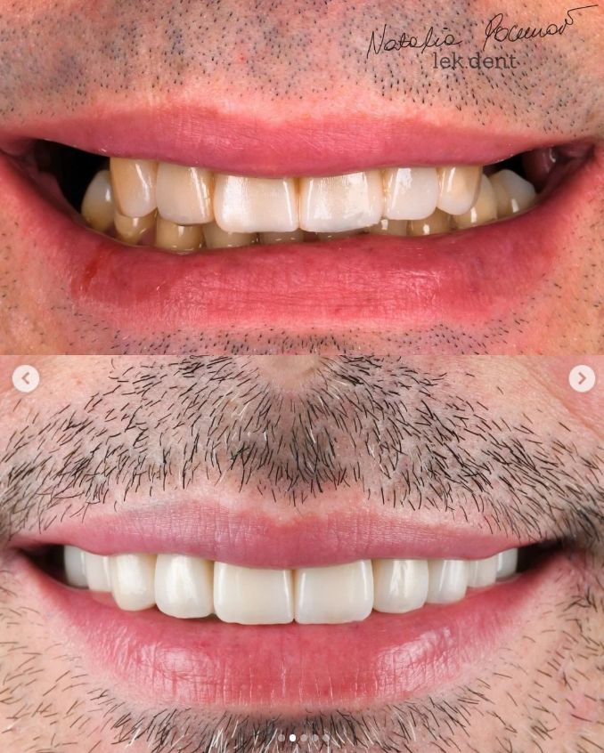 Natalia Pochroń-Sawka-3