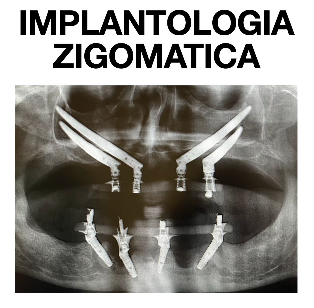 Riccardo Michelotto Tempesta-6