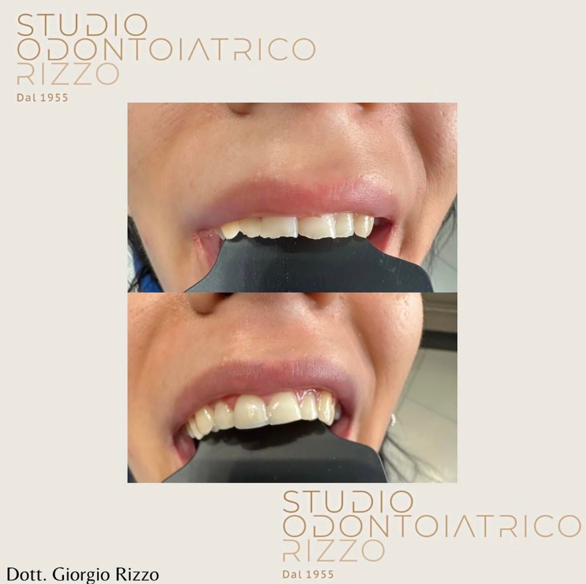 Giorgio Rizzo-4