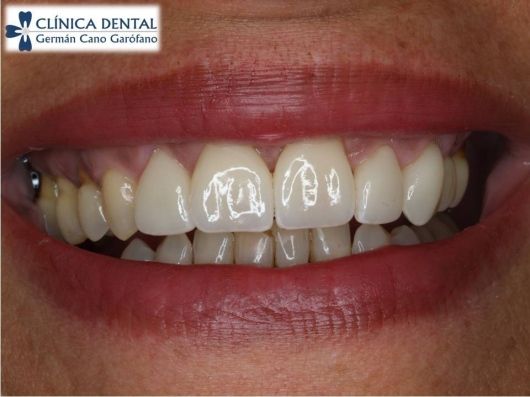 Germán María Cano Garófano-3