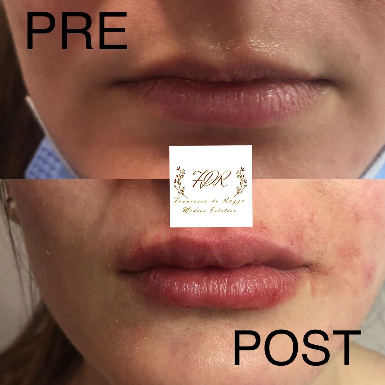 Francesca De Razza-39