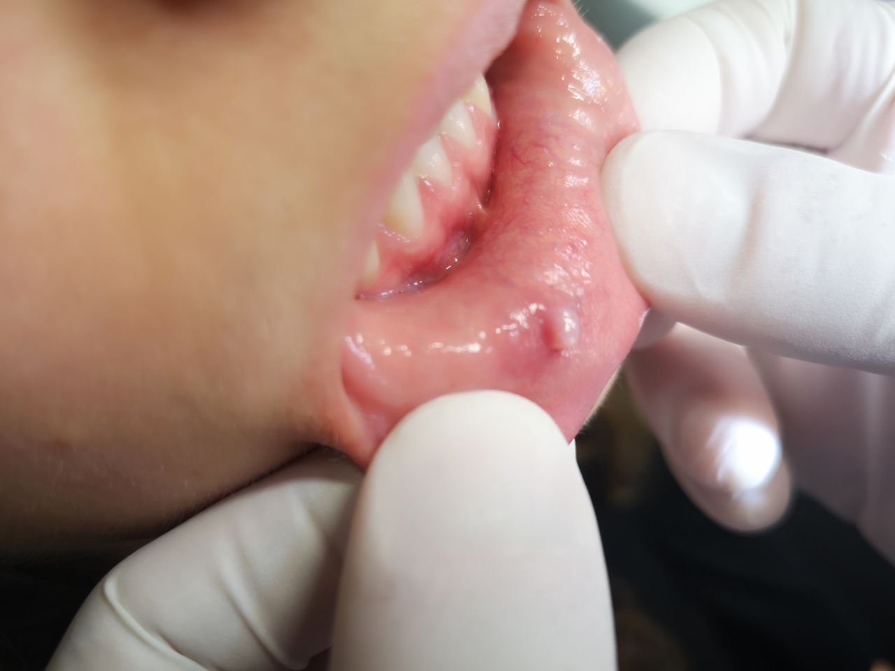 Stefano De Simone-103