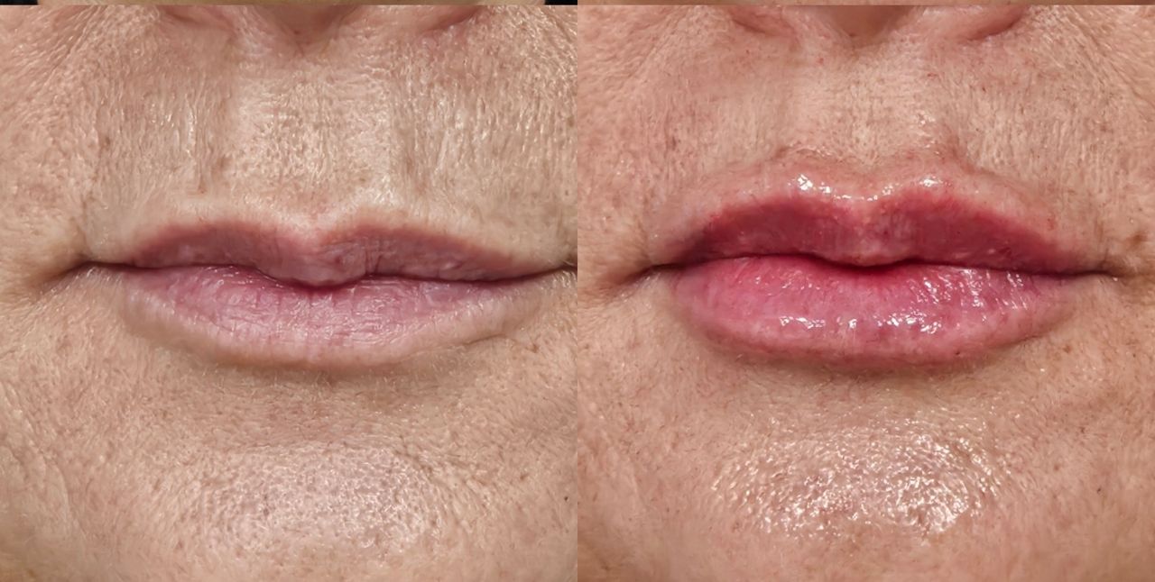 Rosalba Herrero Zerpa-585