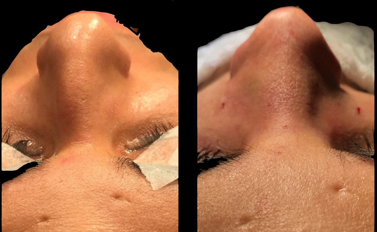 Alvaro Perez Villar-15