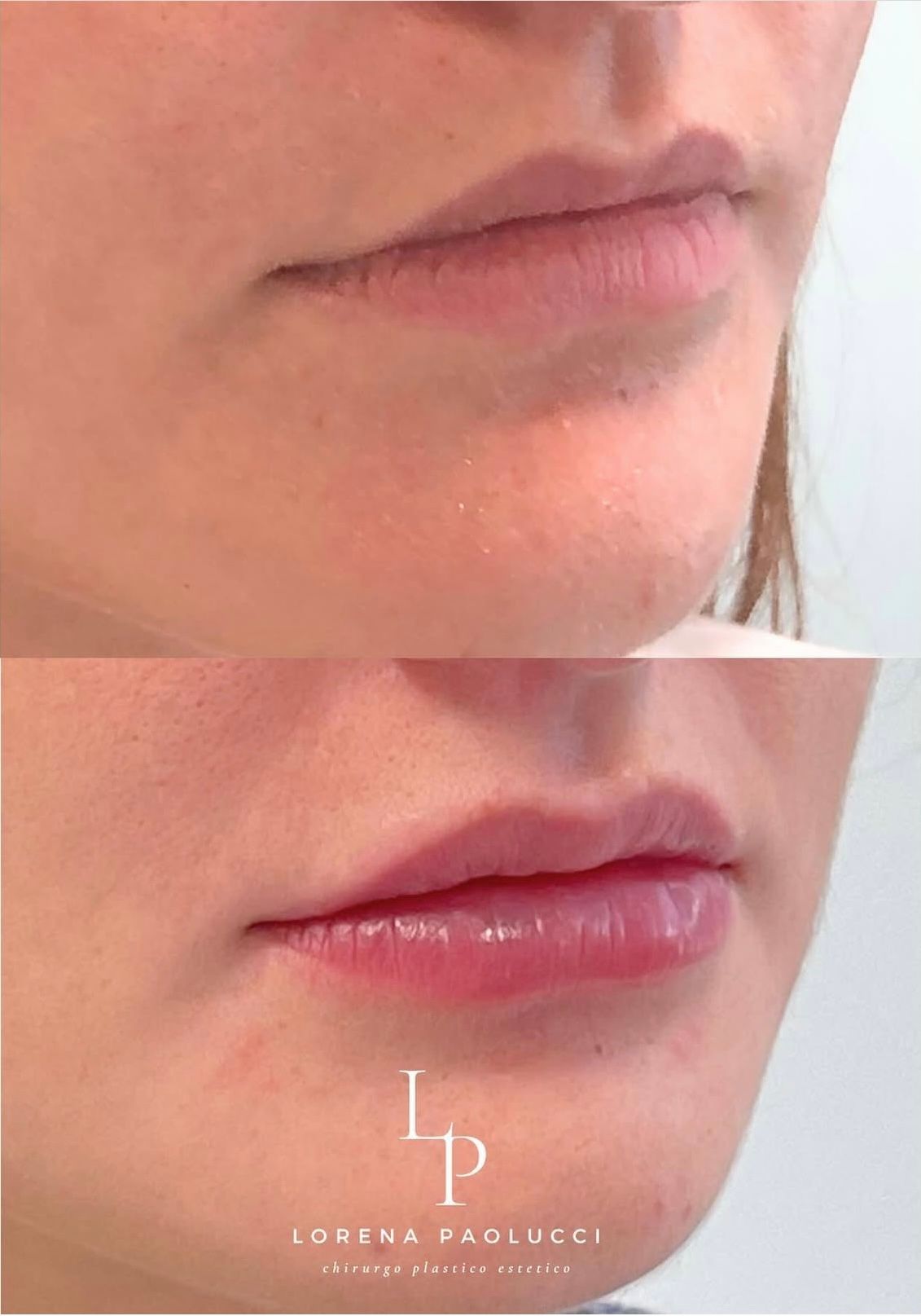 Lorena Paolucci-44