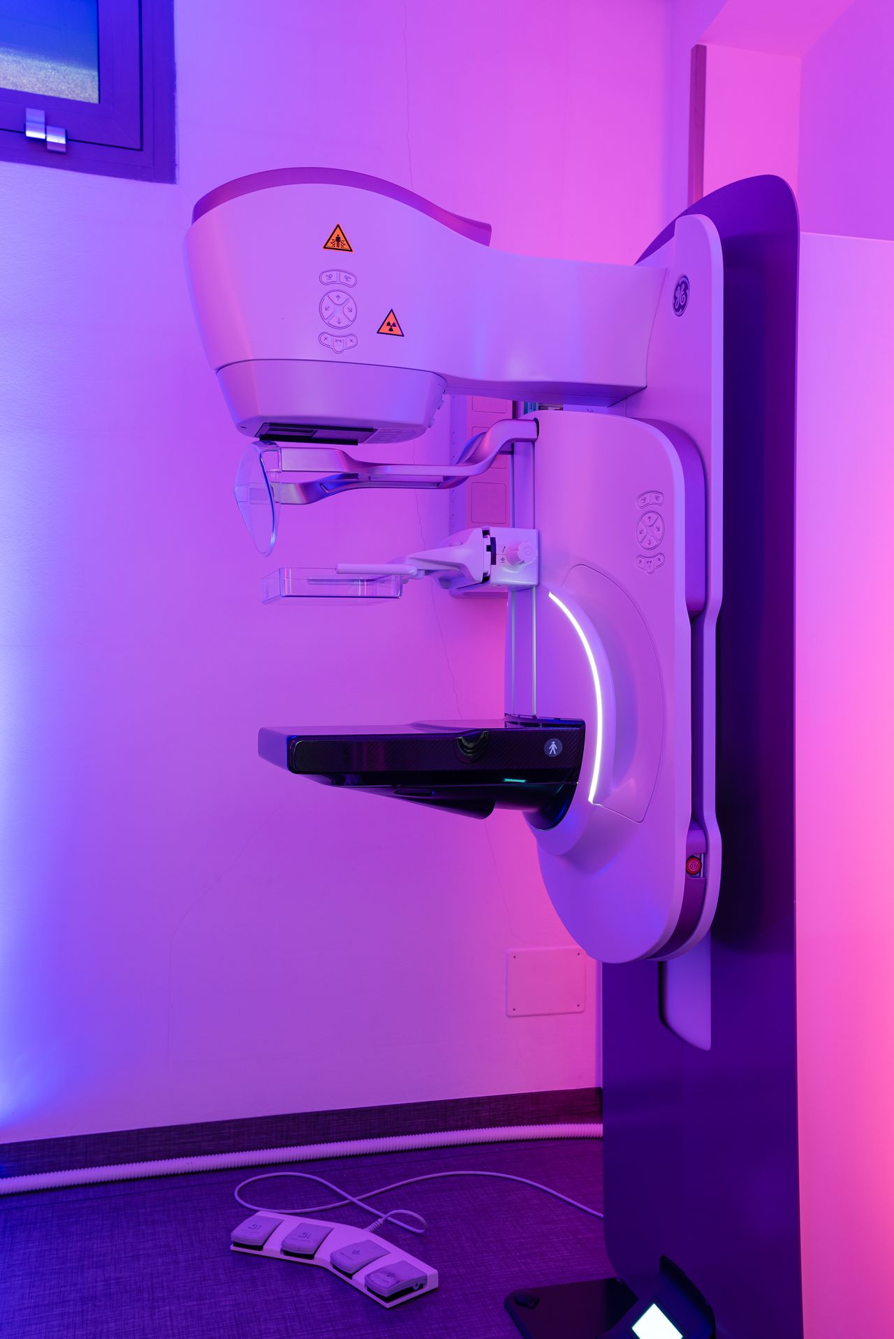 Mammografia Cidimu-1