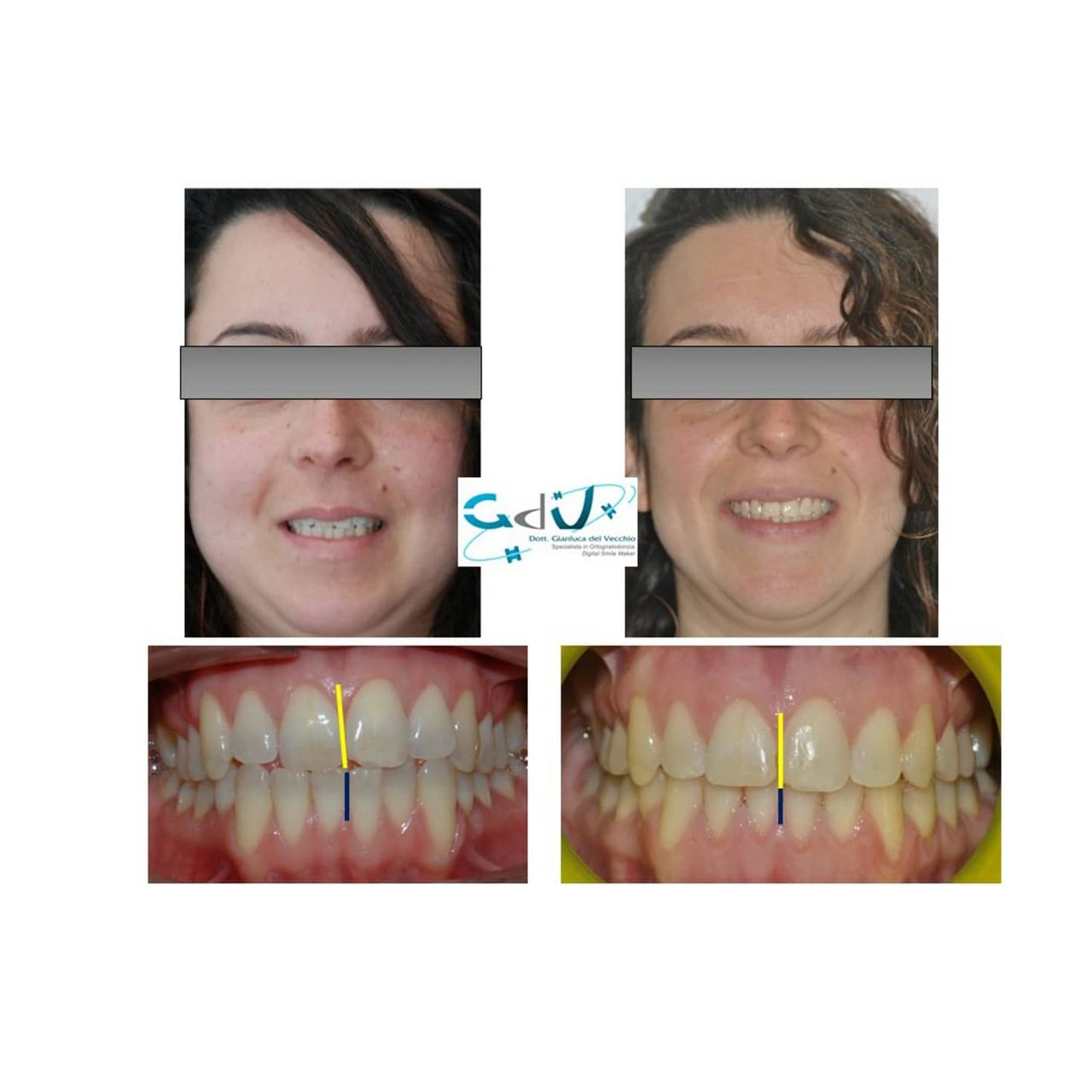 Gianluca Del Vecchio-110