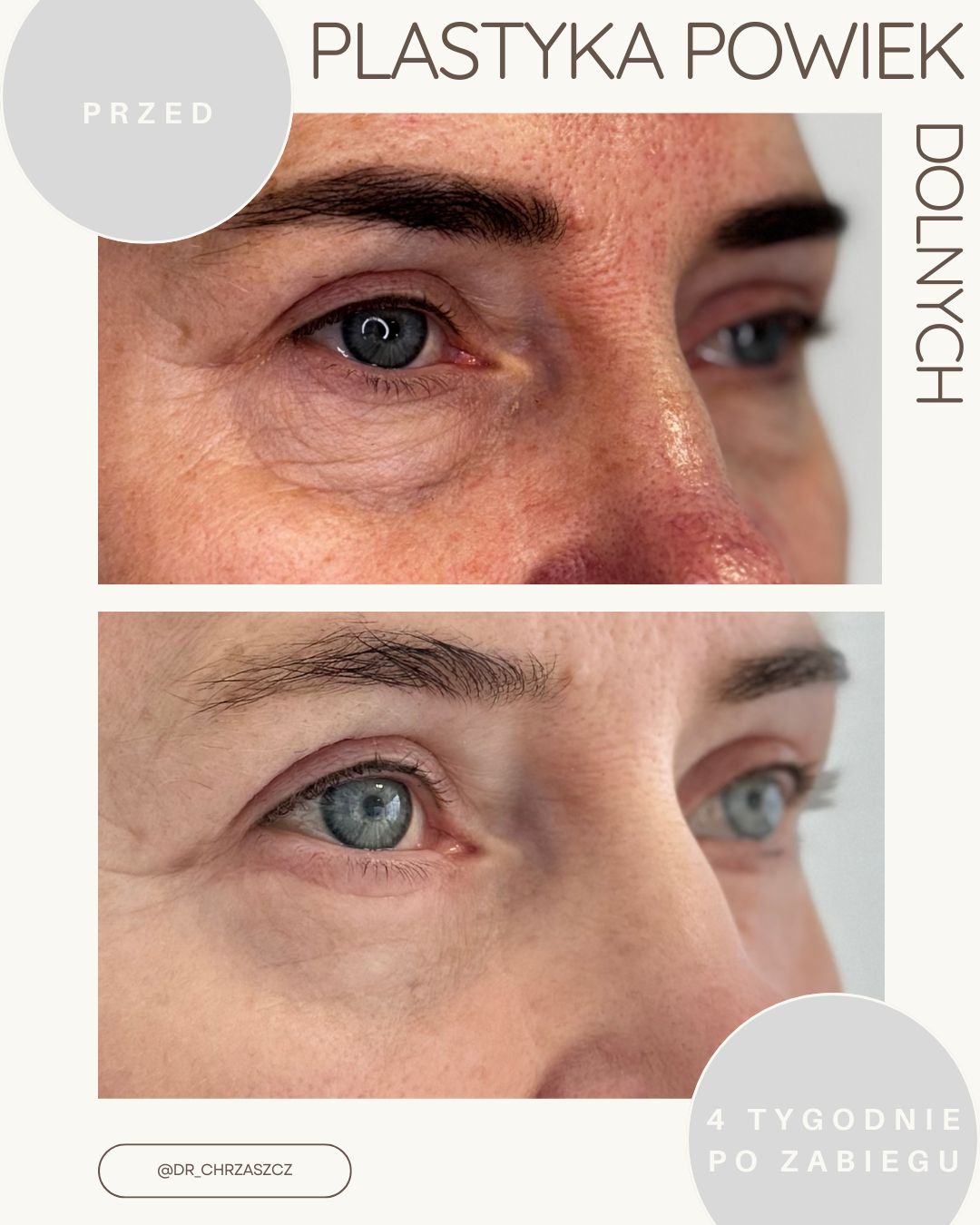 Michał Chrząszcz-11