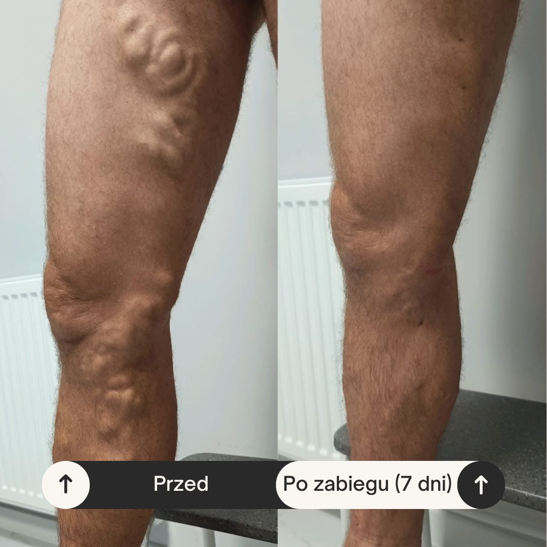 Zbigniew Kupis-0