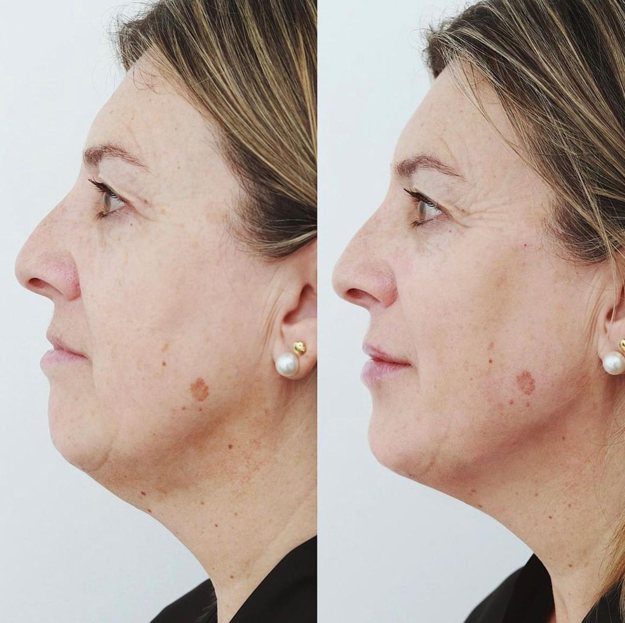 Raquel Moreno Pentinel-57