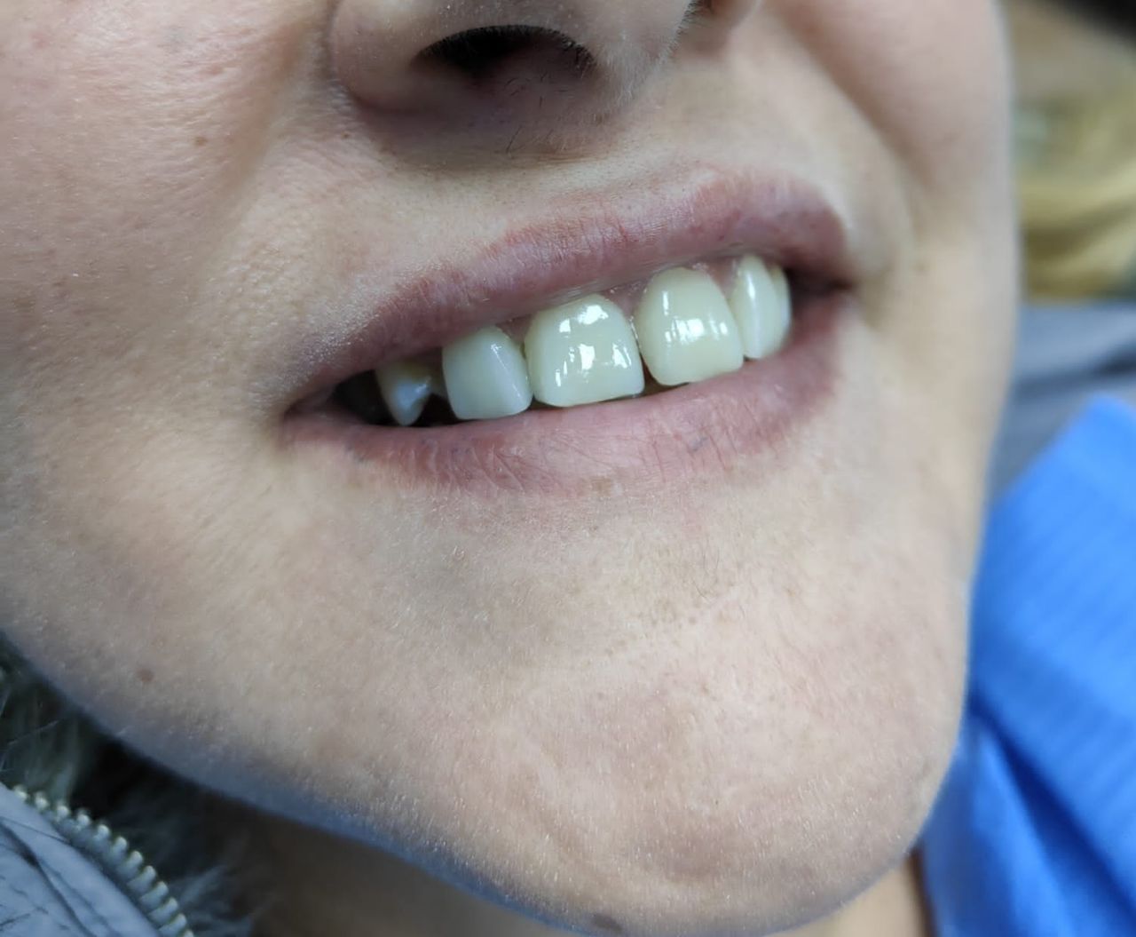 Stefano De Simone-132