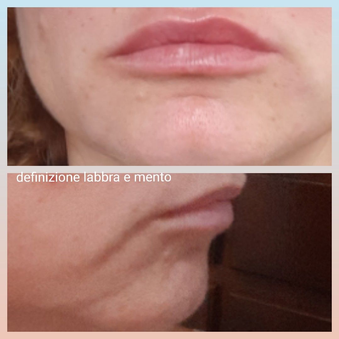 Paola Della Rocca-30