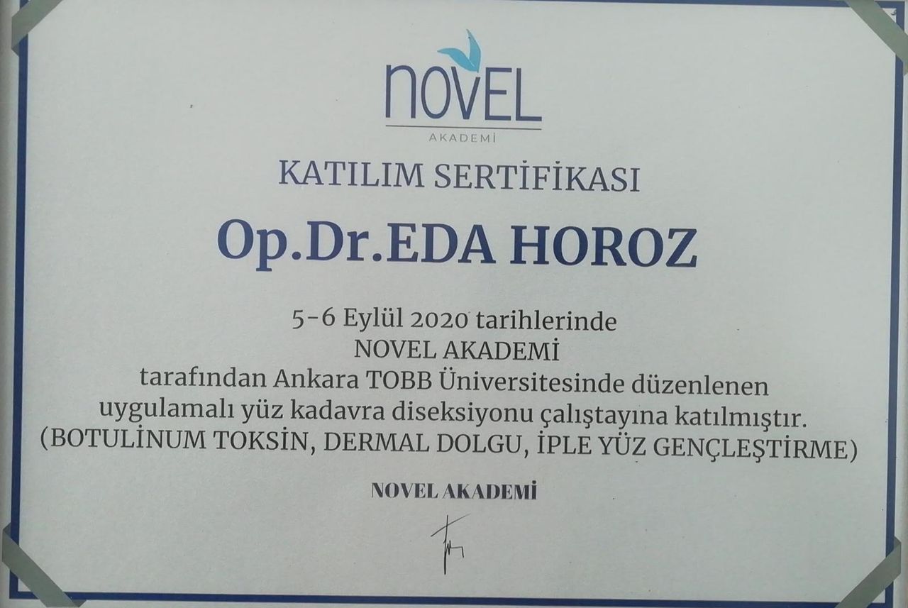 Eda Çabuk Horoz-15