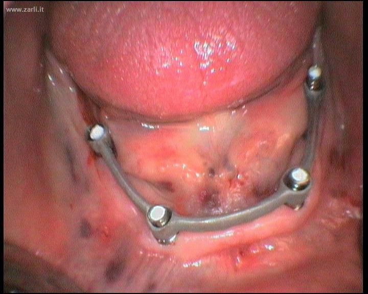 Francesco Dell'andrea-8