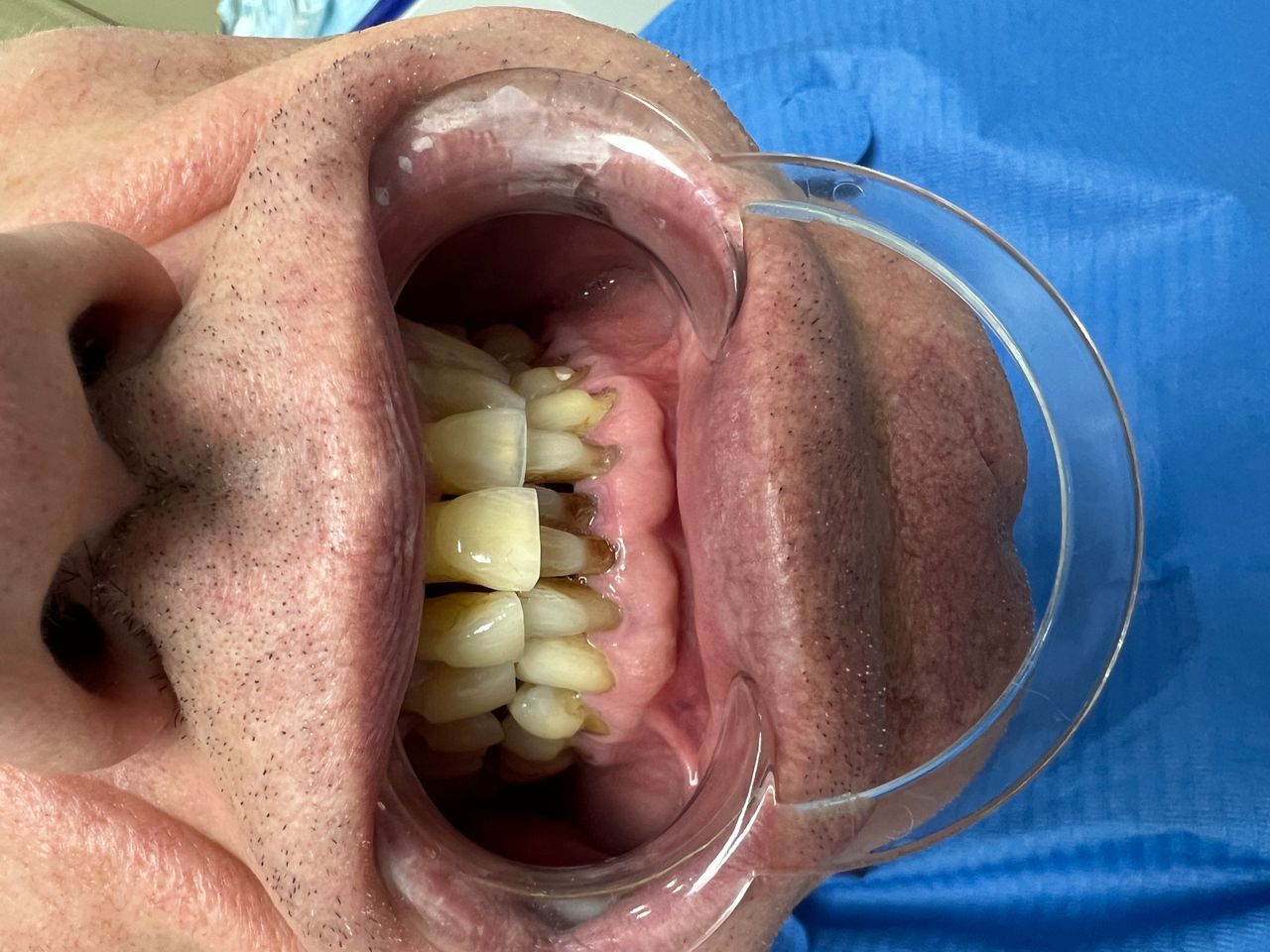 Luigi Aiardo Esposito-9