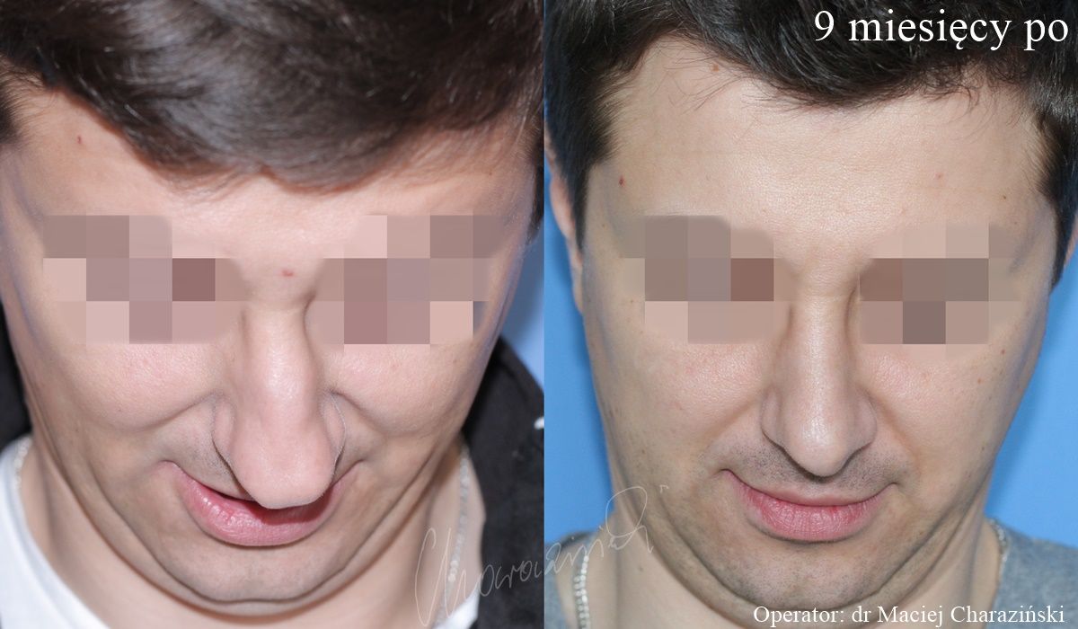 Maciej Charaziński-45