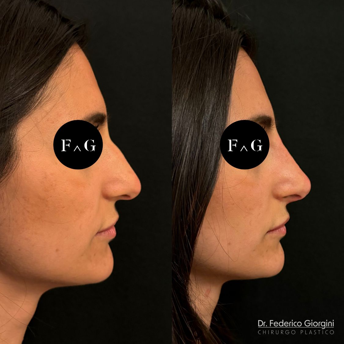 Federico Giorgini-31