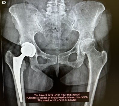 Valerio Cipolloni-15