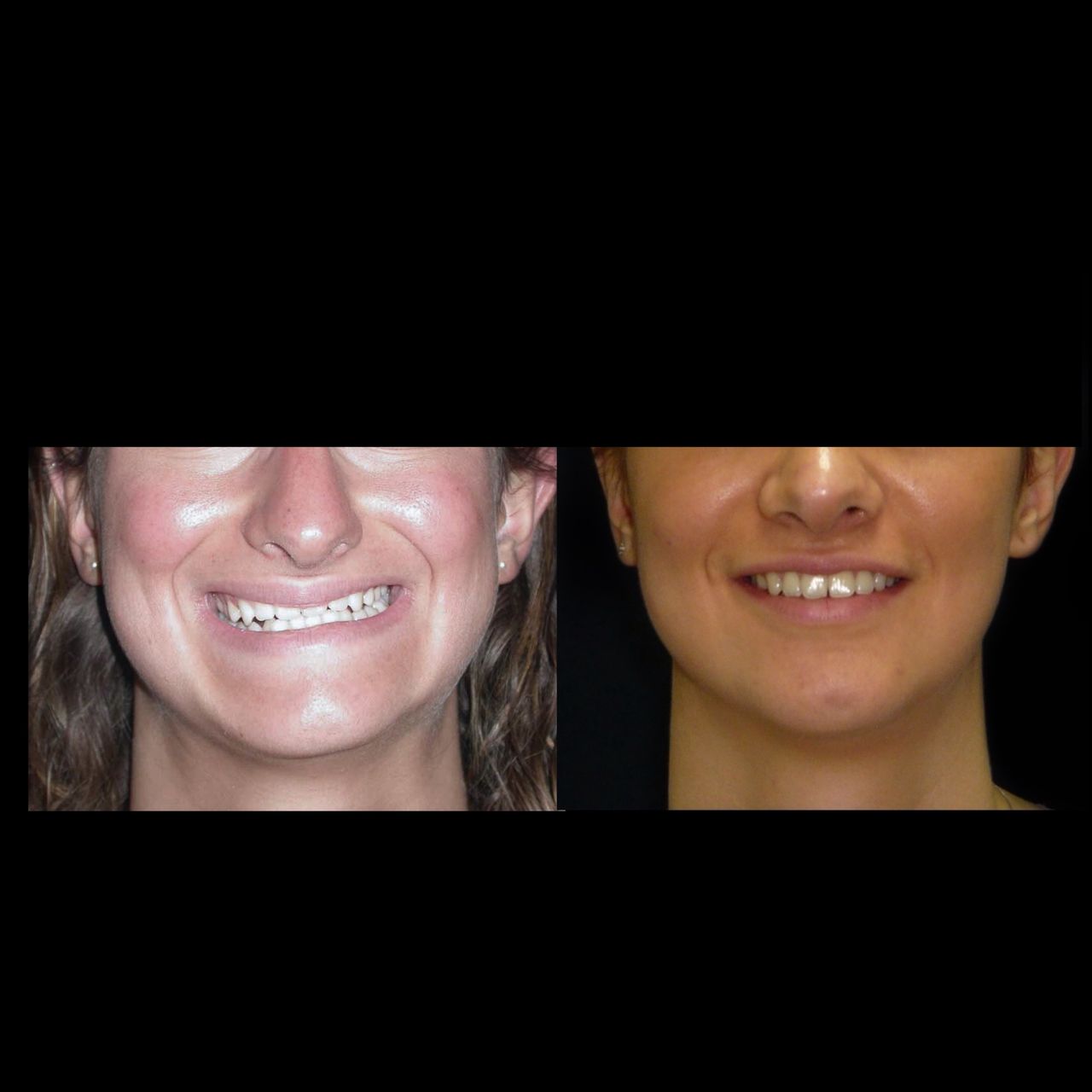 Alessandro Agrillo-3