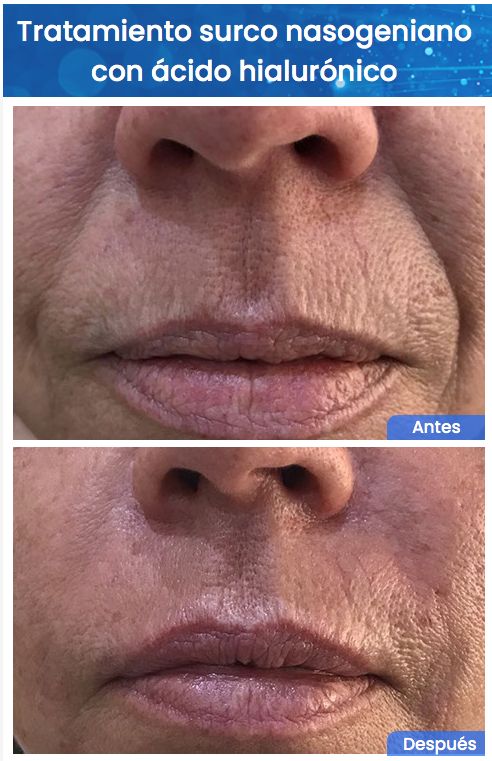 Juan Enrique Pérez Enríquez-145