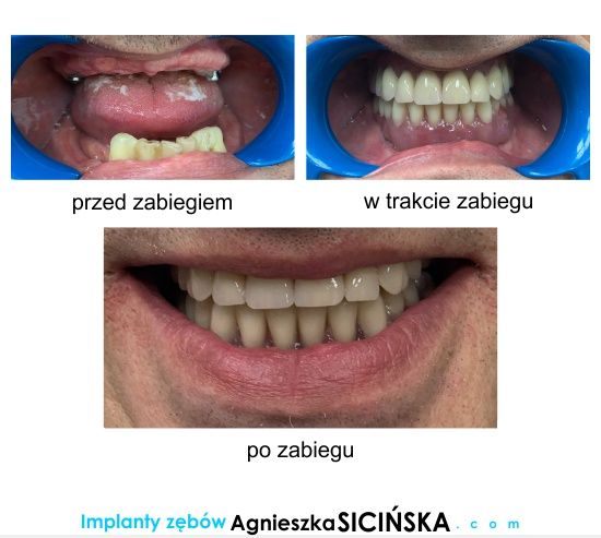 Agnieszka Ewa Sicińska-23