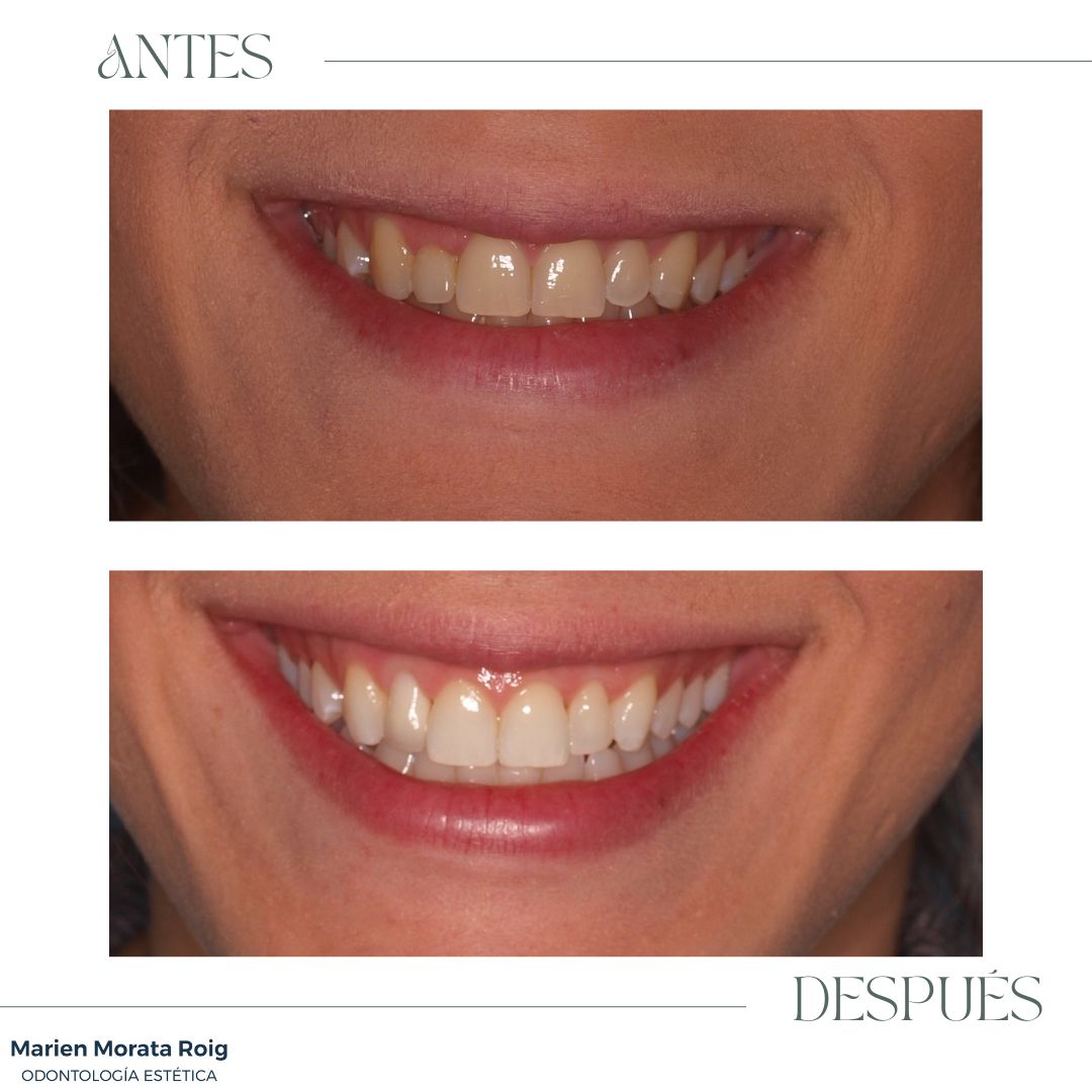 Marien Morata Roig-27