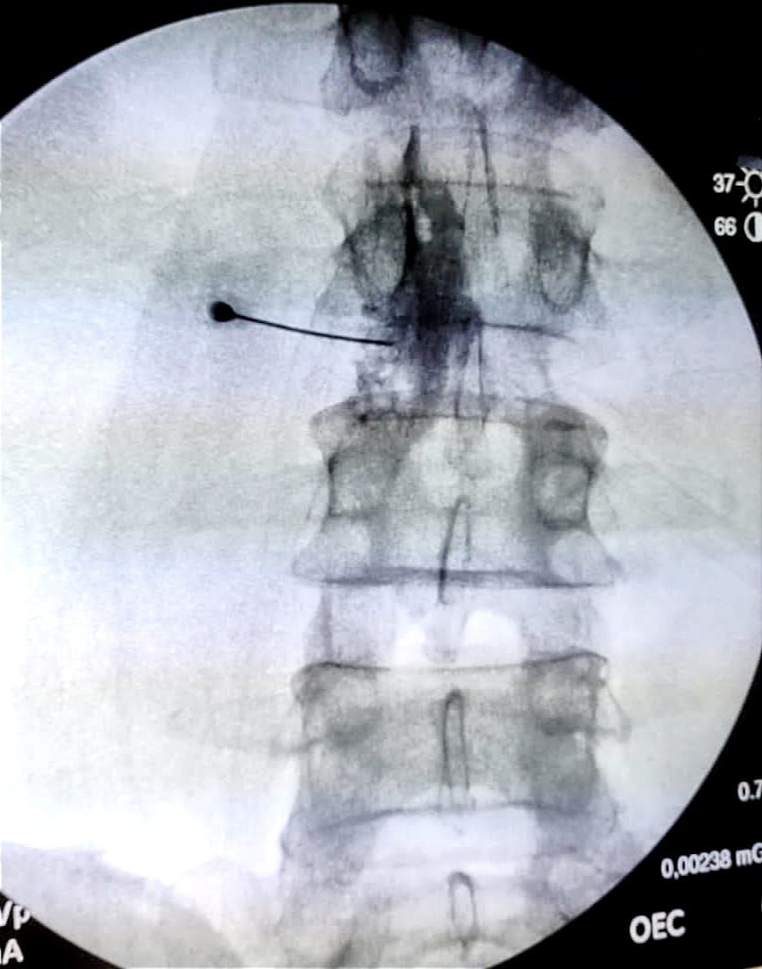 Rafael E. Cuello Santana-3